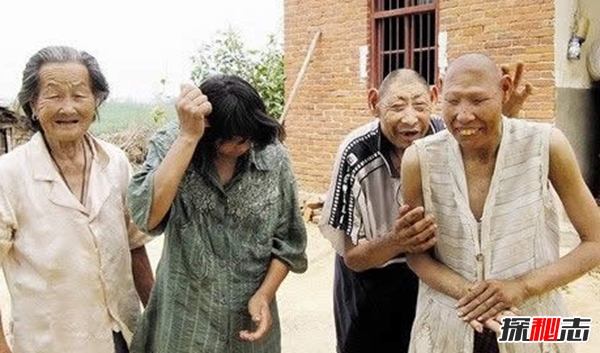神农架猴娃之谜,百岁母亲养育三个猴娃（近亲联姻)