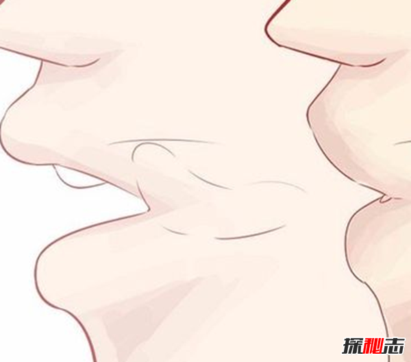 如何矫正大舌头?怎样判断是不是大舌头(吐字不清)