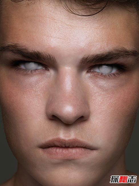 十大世界上最稀有的瞳孔色:你见过银色、粉色瞳孔吗?